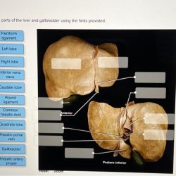 Photomicrograph label hints based pancreas provided pancreatic islet exocrine portion solved transcribed problem text been show has