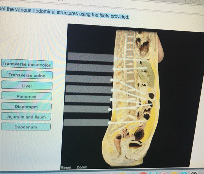 Label the various abdominal structures using the hints provided