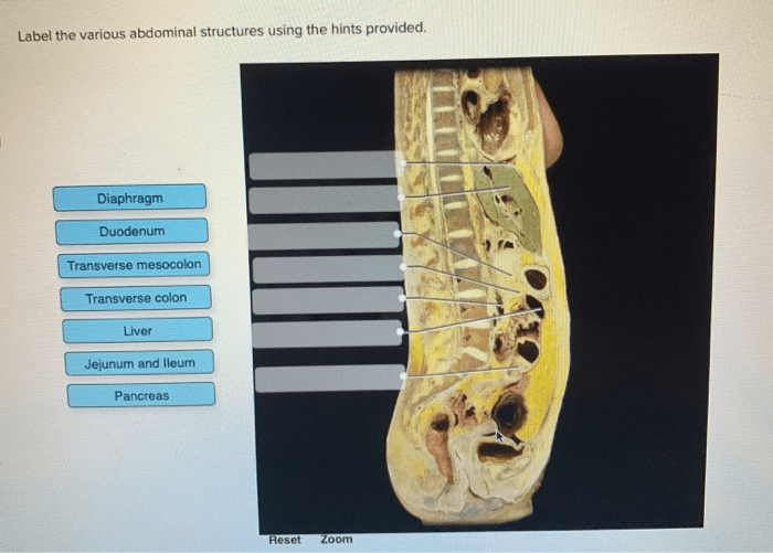 Label the various abdominal structures using the hints provided