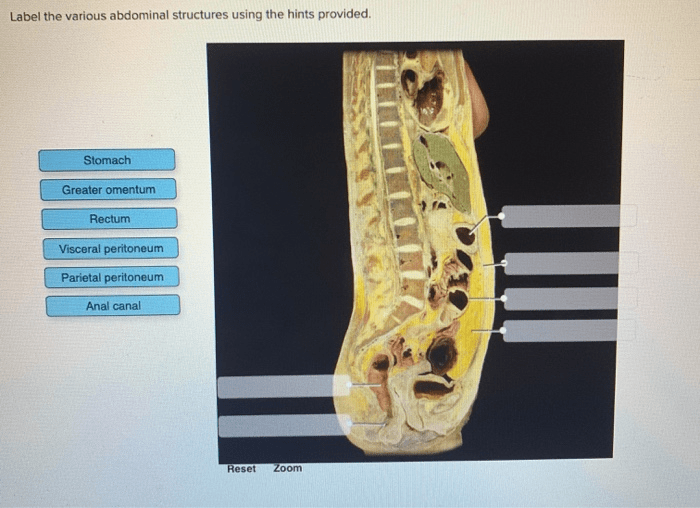 Urinary hints posterior abdominal solved transcribed